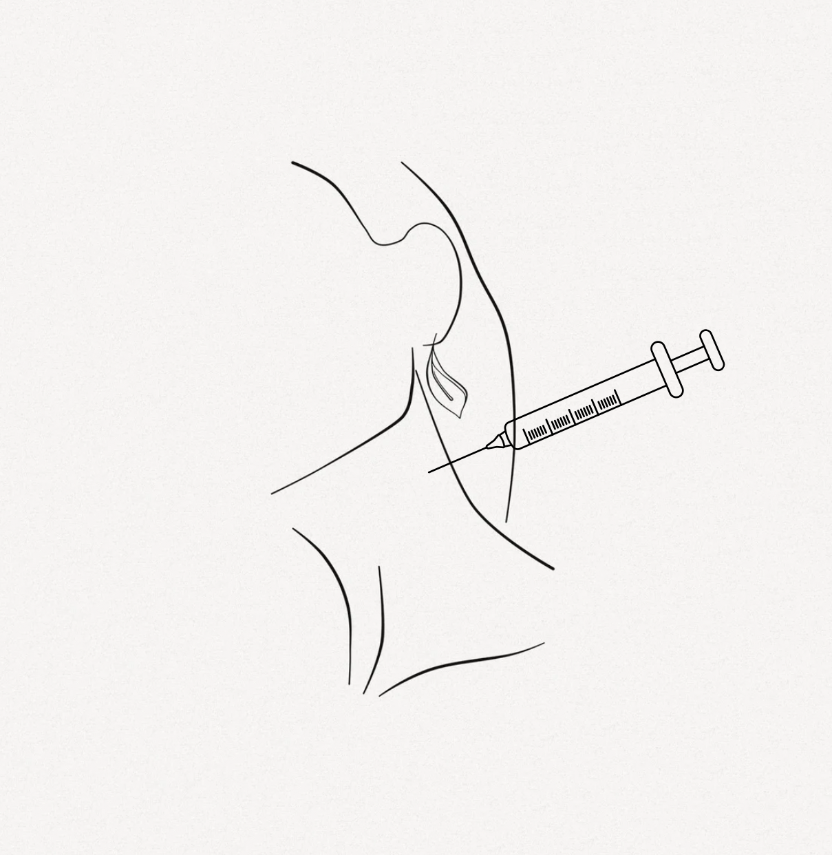 Hals_Spritze Halslifting