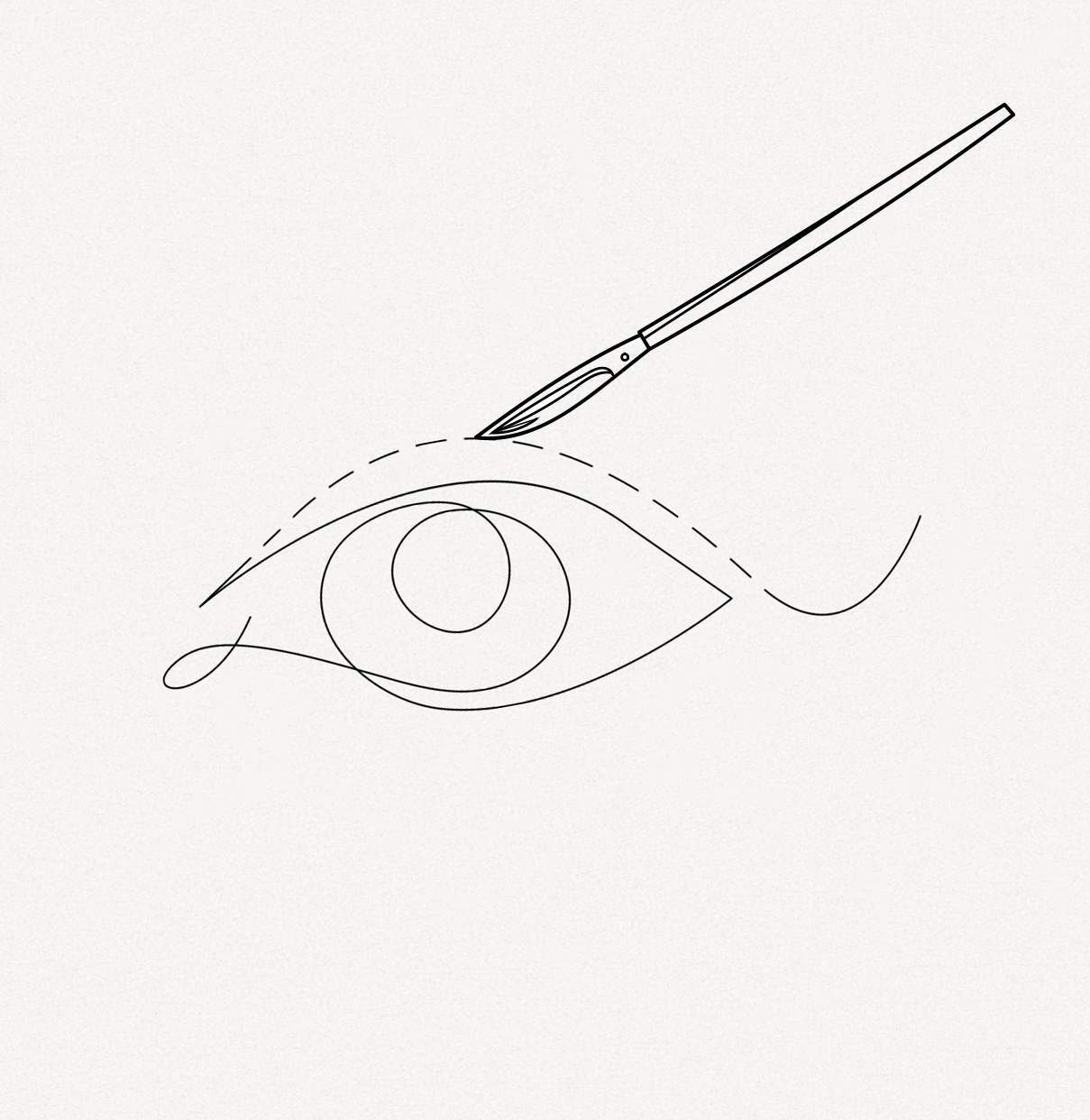 Oberlidstraffung Oberlidstraffung